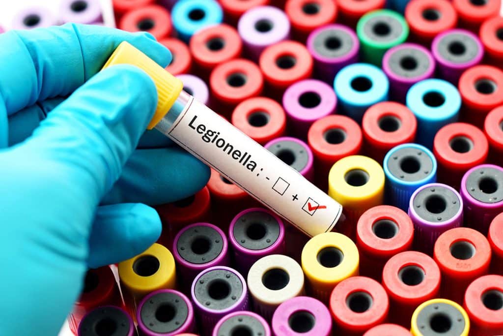 legionella-prevention-water-management - Cross-Connection Control Program | Backflow Prevention - HydroCorp